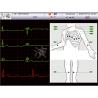 Pantalla ECG CM1200b