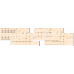 Formatos de impresión electrocardiógrafo CM1200b